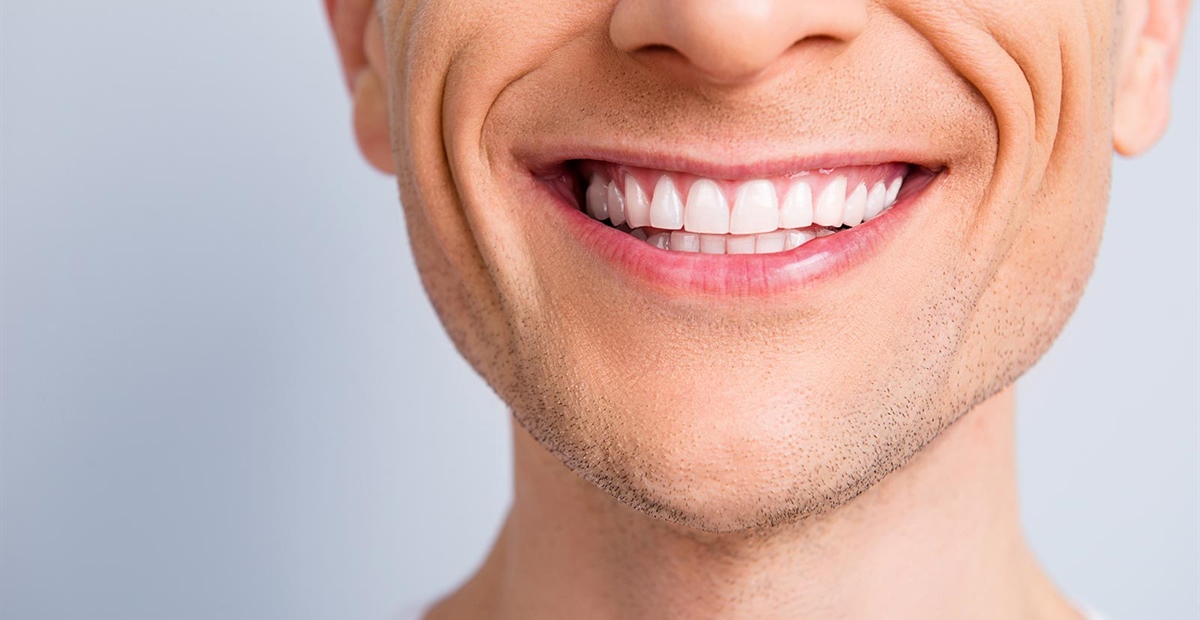 Ästhetische und schonende Komposit-Inlays für die Front- und Seitenzähne