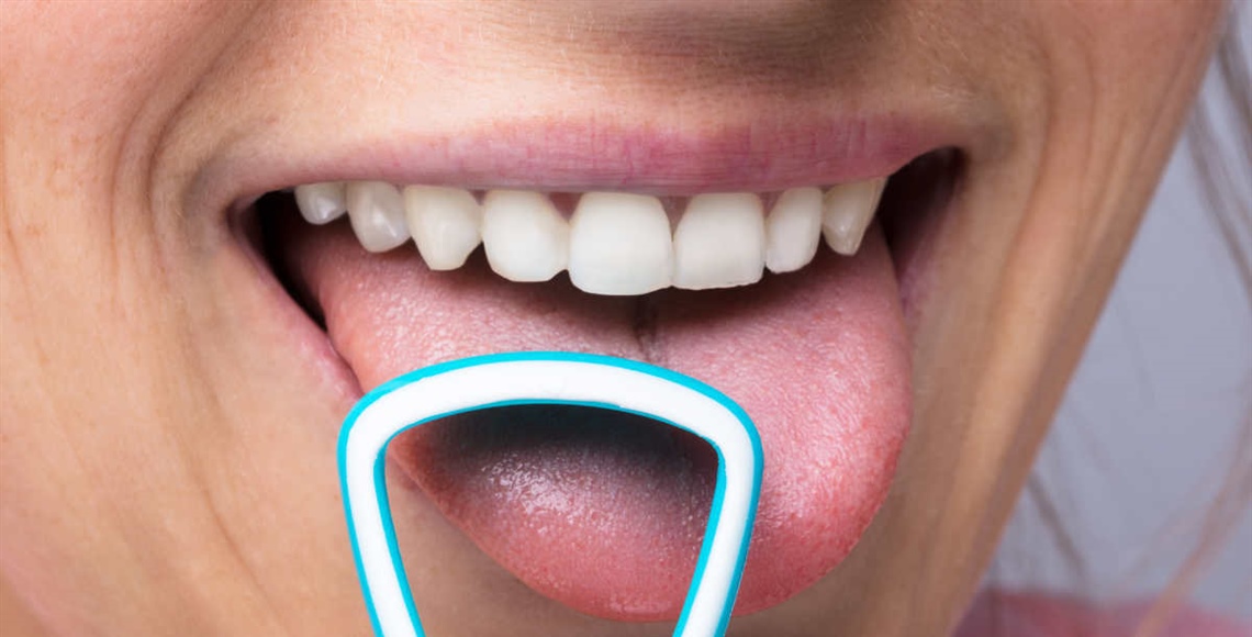 Woher kommt Belag auf der Zunge und was kann man dagegen...