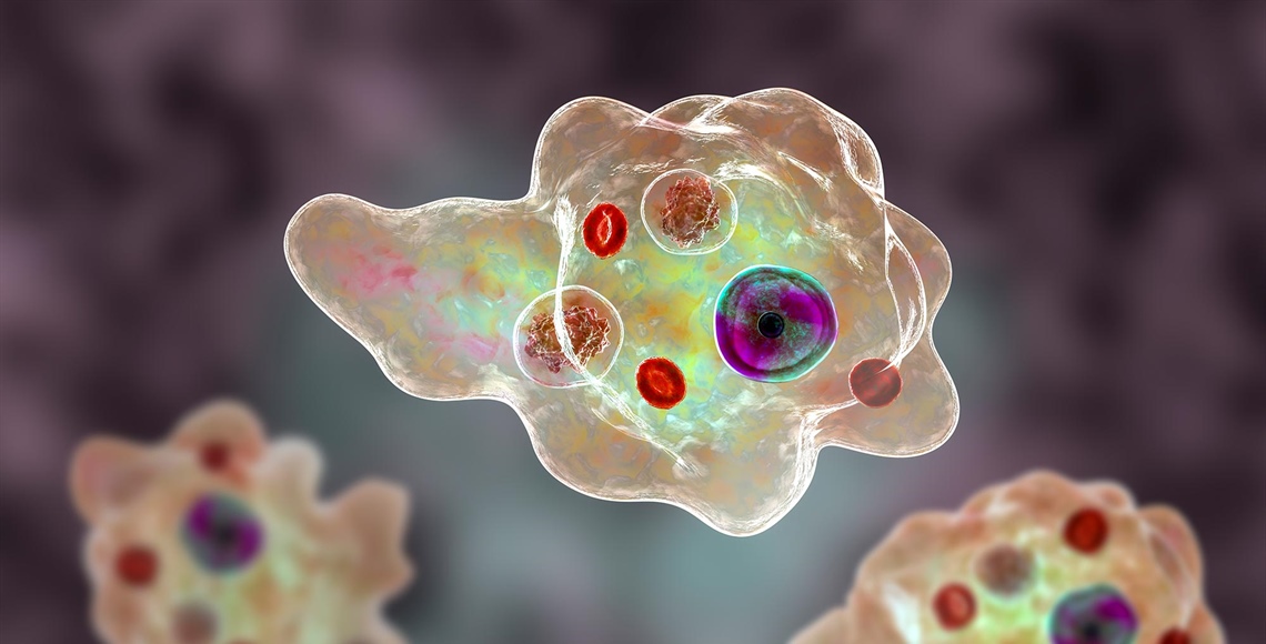Parodontitis erhöht Sterblichkeitsrisiko deutlich