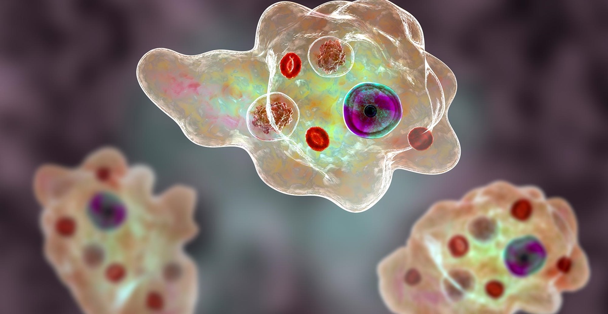 Parodontitis erhöht Sterblichkeitsrisiko deutlich