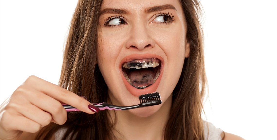 Aktivkohle-Zahnpasta: Schwarzer Trend oder riskante Routine?