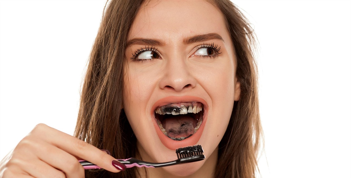 Aktivkohle-Zahnpasta: Schwarzer Trend oder riskante Routine?