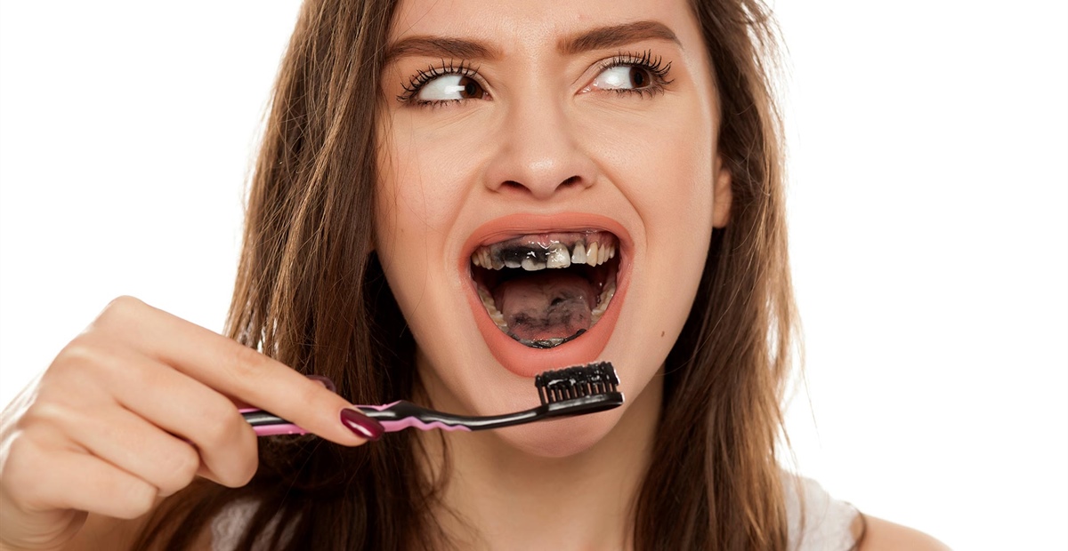 Aktivkohle-Zahnpasta: Schwarzer Trend oder riskante Routine?