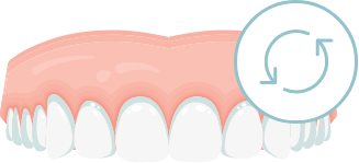Aligner Behandlung als Allround-Lösung