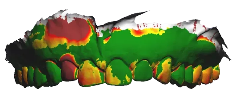 Patienten Monitoring