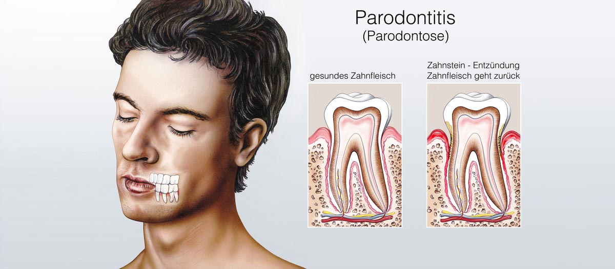 Parodontologie